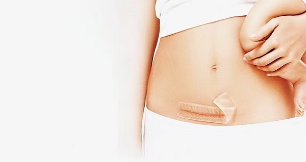 কেন পুরু সিলিকন জেল স্কার শীট এত জনপ্রিয়?